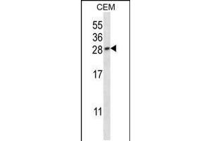 Western blot analysis in CEM cell line lysates (35ug/lane). (PLGF antibody  (AA 120-148))