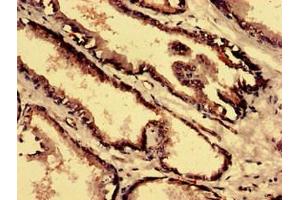 Immunohistochemistry analysis of human prostate tissue using ABIN7148523 at dilution of 1:100