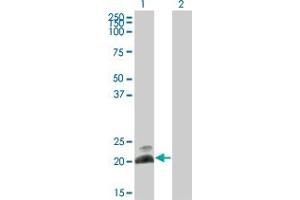 Western Blot analysis of HAND2 expression in transfected 293T cell line by HAND2 monoclonal antibody (M10), clone 3F10.