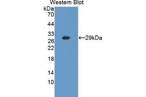 Detection of Recombinant MYLK2, Mouse using Polyclonal Antibody to Myosin Light Chain Kinase 2 (MYLK2) (MYLK2 antibody  (AA 330-548))