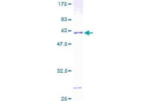 ATP6V1E1 Protein (AA 1-226) (GST tag)