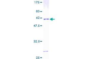 Image no. 1 for ATPase, H+ Transporting, Lysosomal 31kDa, V1 Subunit E1 (ATP6V1E1) (AA 1-226) protein (GST tag) (ABIN1346132) (ATP6V1E1 Protein (AA 1-226) (GST tag))