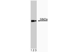 Western blot analysis of Tyrosine Hydroxylase on rat cerebrum lysate. (Tyrosine Hydroxylase antibody  (AA 18-133))
