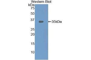 Western blot analysis of recombinant Rat LOX1.