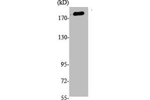 Western Blot analysis of K562, cells using Phospho-Tensin-1 (Y1326) Polyclonal Antibody (Tensin 1 antibody  (pTyr1326))