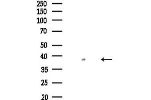 anti-Solute Carrier Family 39 (Zinc Transporter), Member 2 (Slc39a2) (N-Term) antibody