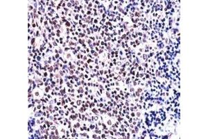 NFATC1 antibody immunohistochemistry analysis in formalin fixed and paraffin embedded human tonsil tissue. (NFATC1 antibody  (AA 898-927))
