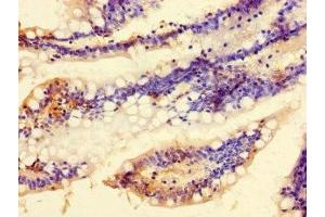 Immunohistochemistry of paraffin-embedded human small intestine tissue using ABIN7174920 at dilution of 1:100 (C9ORF57 antibody  (AA 51-127))