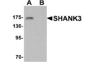 Western blot analysis of SHANK3 in 3T3 cell lysate with SHANK3 antibody at 1 ug/ml in (A) the absence and (B) the presence of blocking peptide. (SHANK3 antibody  (Middle Region))