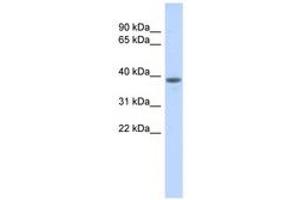 Image no. 1 for anti-DDB1 and CUL4 Associated Factor 4-Like 1 (DCAF4L1) (AA 323-372) antibody (ABIN6741260) (DCAF4L1 antibody  (AA 323-372))