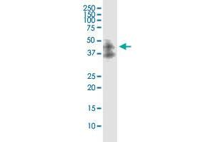 Western Blotting (WB) image for anti-Death-Associated Protein Kinase 2 (DAPK2) (AA 281-370) antibody (ABIN565126)
