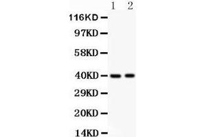 Anti- MUM1 antibody, Western blotting All lanes: Anti MUM1  at 0. (IRF4 antibody  (AA 272-451))