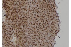ABIN6277430 at 1/100 staining Rat liver tissue by IHC-P. (RAD52 antibody  (Internal Region))