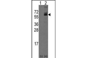 Western blot analysis of Noelin-1(Olfm1) (arrow) using rabbit polyclonal Noelin-1(Olfm1) Antibody (C-term) (ABIN389178 and ABIN2839341). (Olfactomedin 1 antibody  (C-Term))