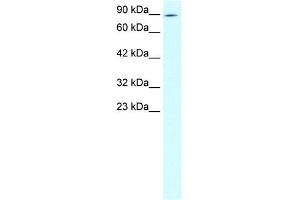 WB Suggested Anti-ZNF341 Antibody Titration: 2. (ZNF341 antibody  (N-Term))