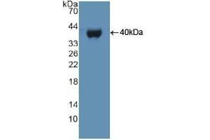 Detection of Recombinant UBE3A, Human using Polyclonal Antibody to Ubiquitin Protein Ligase E3A (UBE3A) (ube3a antibody  (AA 158-407))