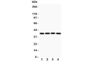 Western blot testing of MCL1 antibody and Lane 1:  rat spleen;  2: human HEPG2;  3: (h) MCF-7;  4: (h) COLO320 (MCL-1 antibody  (AA 1-350))
