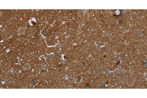 Immunohistochemistry of paraffin-embedded Human brain using GALT Polyclonal Antibody at dilution of 1:30 (GALT antibody)