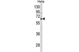 Western blot analysis of CTPS2 Antibody (N-term) in Hela cell line lysates (35ug/lane). (CTPS2 antibody  (N-Term))