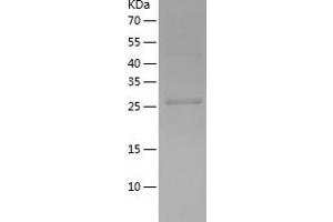 Western Blotting (WB) image for Twinfilin, Actin-Binding Protein 1 (TWF1) (AA 100-350) protein (His tag) (ABIN7287028) (TWF1 Protein (AA 100-350) (His tag))