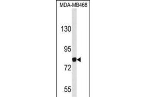 Western blot analysis of EVI5 Antibody (N-term) (ABIN653115 and ABIN2842698) in MDA-M cell line lysates (35 μg/lane). (EVI5 antibody  (N-Term))