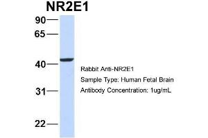 Western Blotting (WB) image for anti-Nuclear Receptor Subfamily 2, Group E, Member 1 (NR2E1) (Middle Region) antibody (ABIN2777931)