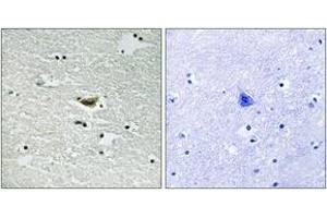 Immunohistochemistry analysis of paraffin-embedded human brain, using CK-1 alpha (Phospho-Tyr294) Antibody. (CSNK1A1 antibody  (pTyr294))