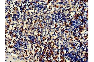 Immunohistochemistry of paraffin-embedded human spleen tissue using ABIN7149082 at dilution of 1:100 (CDA antibody  (AA 1-146))
