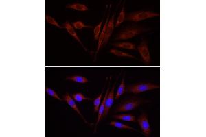 Immunofluorescence analysis of NIH/3T3 cells using WNT1 antibody (ABIN1683291, ABIN3016105, ABIN3016107 and ABIN6219551) at dilution of 1:100. (WNT1 antibody  (AA 231-370))