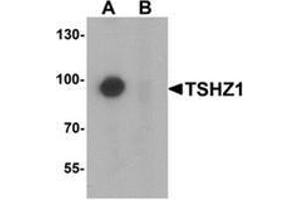 Western blot analysis of TSHZ1 in A-20 cell lysate with TSHZ1 Antibody  at 1 µg/ml in (A) the absence and (B) the presence of blocking peptide.
