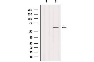 Western blot analysis of extracts from Hela, using SLC16A2 Antibody. (SLC16A2/MCT8 antibody  (Internal Region))