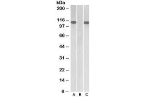 Western blot of HEK293 lysate overexpressing human Furin with MYC tag probed with Furin antibody [1ug/ml] in Lane A and probed with anti-MYC tag [1/1000] in lane C. (FURIN antibody)
