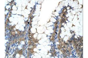Image no. 1 for anti-Peptidylprolyl Isomerase A (Cyclophilin A) (PPIA) (C-Term) antibody (ABIN321858) (PPIA antibody  (C-Term))