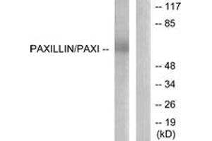 Western blot analysis of extracts from HeLa cells, using Paxillin (Ab-118) Antibody.
