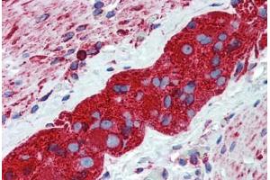 Human Small Intestine, Myenteric Plexus: Formalin-Fixed, Paraffin-Embedded (FFPE) (TUBB2A antibody  (AA 1-446))