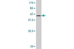 Western Blot detection against Immunogen (59. (TADA2L antibody  (AA 1-305))