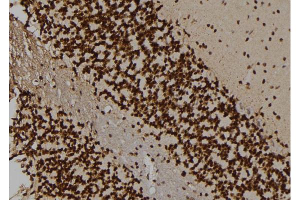 ALPK2 antibody  (Internal Region)
