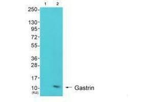 Western blot analysis of extracts from K562 cells (Lane 2), using Gastrin antiobdy. (Gastrin antibody)
