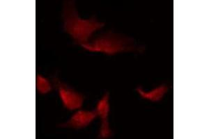 Immunofluorescence (fixed cells) (IF/ICC) image for anti-SMAD, Mothers Against DPP Homolog 2 (SMAD2) (C-Term) antibody (ABIN6265170)