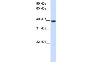 AGPAT5 antibody used at 1 ug/ml to detect target protein. (AGPAT5 antibody)