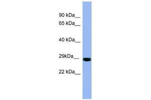 RAB1A antibody used at 1 ug/ml to detect target protein.