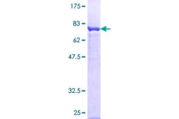 PRKAR1A Protein (AA 1-381) (GST tag)