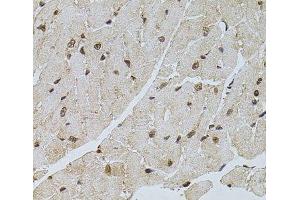 Immunohistochemistry of paraffin-embedded Mouse heart using PPP2R5C Polyclonal Antibody at dilution of 1:100 (40x lens). (PPP2R5C antibody)