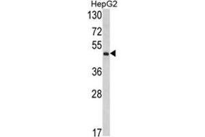 Western blot analysis of OTC Antibody (Center) in HepG2 cell line lysates (35ug/lane). (OTC antibody  (Middle Region))