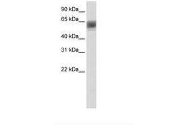 ARID3B anticorps  (AA 131-180)