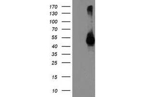 Western Blotting (WB) image for anti-Transmembrane Protease, serine 5 (TMPRSS5) antibody (ABIN1501446) (TMPRSS5 antibody)