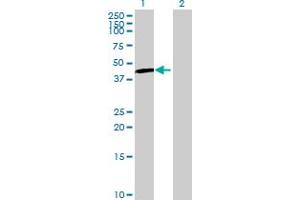 UGT3A1 antibody  (AA 1-523)