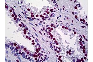 Anti-TRIM28 antibody IHC of human prostate. (KAP1 antibody  (AA 379-524))