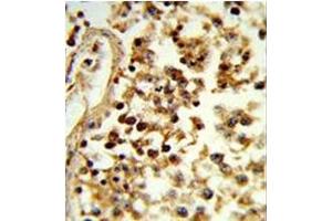 Formalin-fixed and paraffin-embedded human testis tissue reacted with IL31 Antibody (N-term), which was peroxidase-conjugated to the secondary antibody, followed by DAB staining. (IL-31 antibody  (N-Term))
