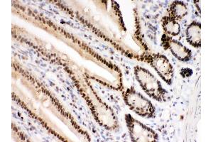 Immunohistochemistry (IHC) image for anti-Poly (ADP-Ribose) Polymerase 1 (PARP1) (AA 670-858) antibody (ABIN3043378)